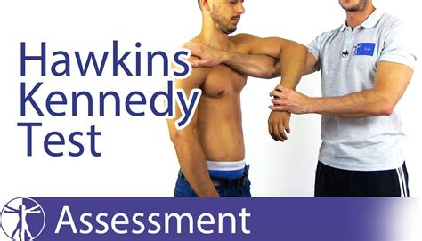 The Hawkins Kennedy Test For Subacromial Pain Syndrome Saps The