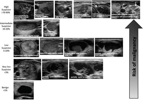 The Application Of Sonographic Patterns To Risk Stratification Of