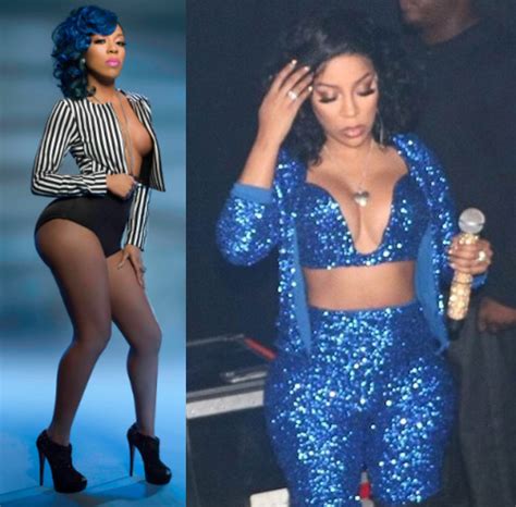 K Michelle Plastic Surgery Before And After Photos