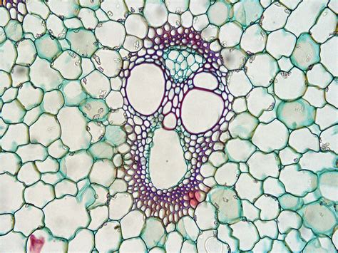 Xylem Under Microscope