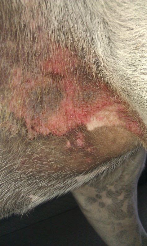 20 Abscesses Lacerations Skin Issues And More Images Skin Issues