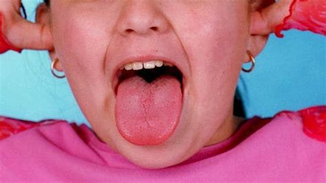 Girl 8 Gets Tongue Stuck In Glass Drink Bottle The Courier Mail