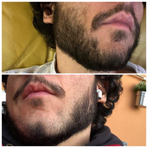 Help Me Style My Beard That Wont Connect 😖 Top Is Me Atm Bottom Is