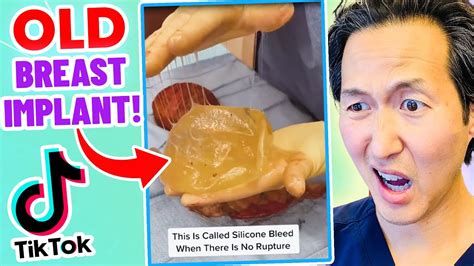 Plastic Surgeon Reacts To Fascinating Dermatology Tiktok Videos Youtube
