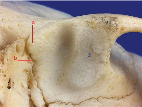 8 Temporomandibular Joint Pocket Dentistry