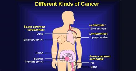 4 Early Warning Signs Of Cancer That Cannot Be Ignored
