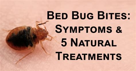 Bed Bug Bites Symptoms And 5 Natural Treatments David Avocado Wolfe