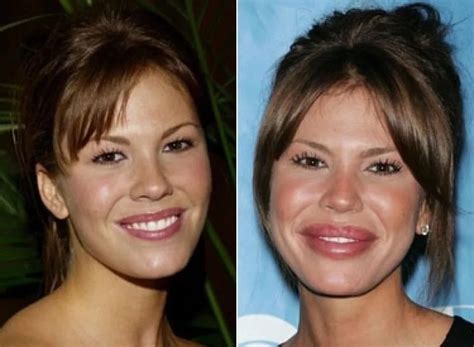 15 most outrageous plastic surgery fails faculty of medicine