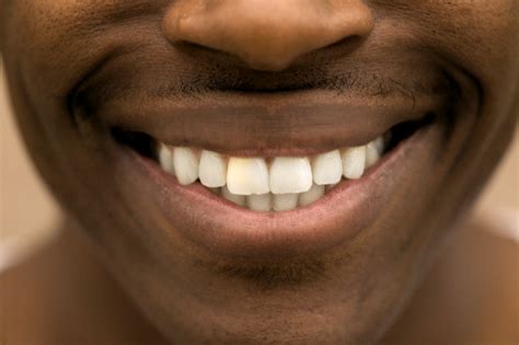9 Things Thy Teeth Want You To Stop Doing Thyblackman