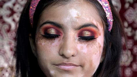 How To Cover Vitiligo In Makeup कोढ़ Easy Leukoderma Bridal Makeup Tutorial