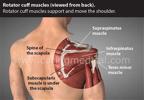 Partial Rotator Cuff Tear Do You Really Need A Surgery Caring