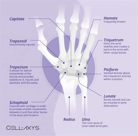 Ulnar Wrist Pain Why Ulnar Shortening Osteotomy Is Not Ideal Cellaxys