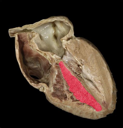Internal Heart Anatomy Cadaver Flashcards Quizlet