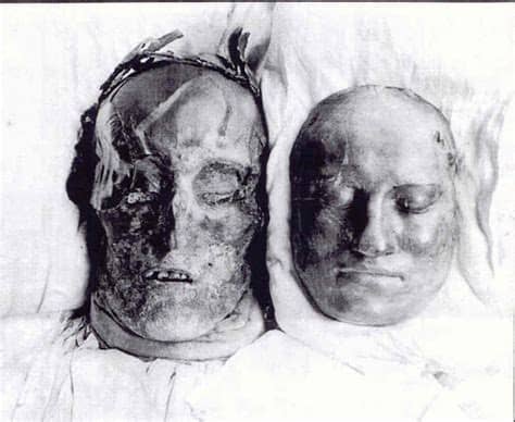 Till sin hjälp har han flera av världens ledande experter inom medicin, sårballistik och vapenteknik. Lady Katherine - Karl XII's Dödsmask(er)