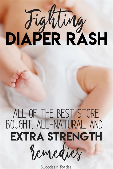 Curing Stubborn Diaper Rash Methods That Work Quickly Swaddles N