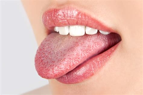 Жжение во рту причины симптомы лечение как избавиться от жжения во рту
