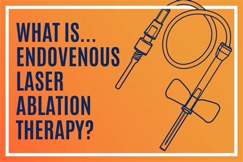 Uva Radiology Endovenous Laser Ablation Therapy Evlt