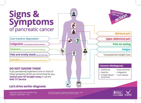 Pancreatic cancer begins when abnormal cells in the pancreas grow and divide out of control and form a tumor. Symptoms Poster · Pancreatic Cancer Action