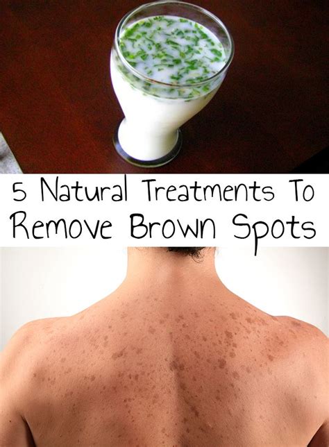 Brown Spots 5 Natural Treatments To Remove Brown Spots Dry Skin