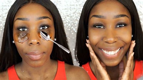 How To Get Rid Of Dark Circles Under Eyes On Black Skin