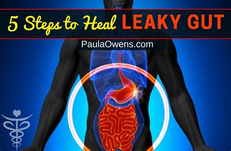 5 Step Formula To Heal Leaky Gut Naturally Paula Owens