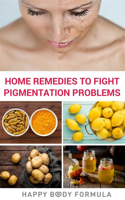 5 Home Remedies To Fight Skin Pigmentation Problems Happybodyformula