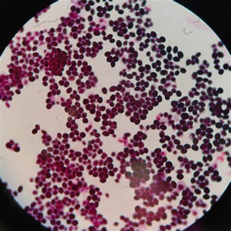Saccharomyces Cerevisiae Under Microscope