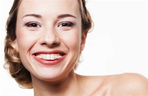 5 Reasons To Get Braces As An Adult Snodgrass King