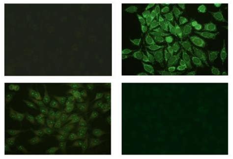 Examples Of Indirect Immunofluorescence IIF Images With Different
