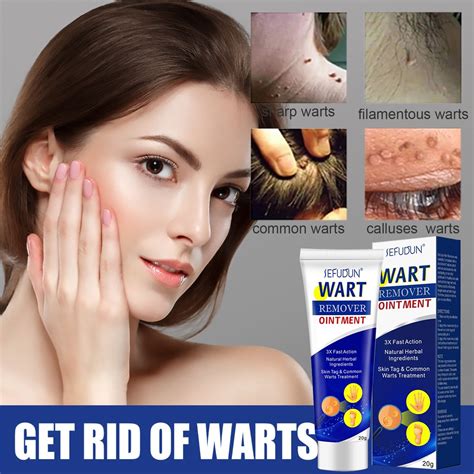 sefudun warts remover cream mole skin tag kulogo genital warts remover fast effective shopee