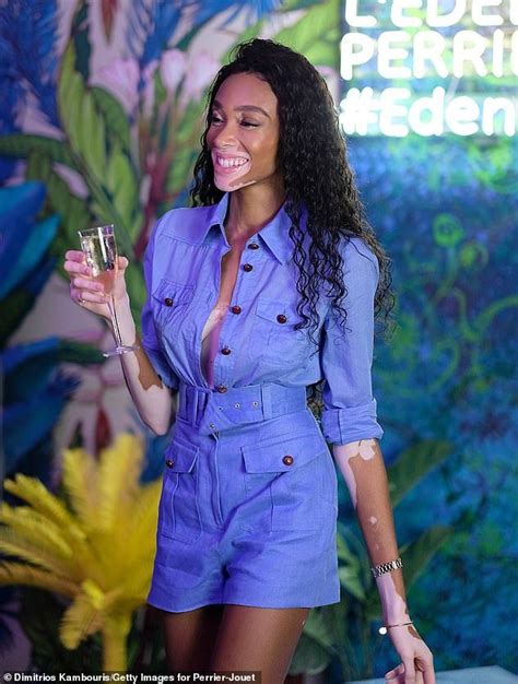 Winnie Harlow Parties With The Hilton Sisters In Miami