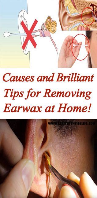 Causes And Brilliant Tips For Removing Earwax At Home Health Tips