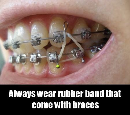 If you are in a great deal of pain from your unfortunately, yes. 21 Ways To Relieve Pain From Braces Naturally - Natural ...