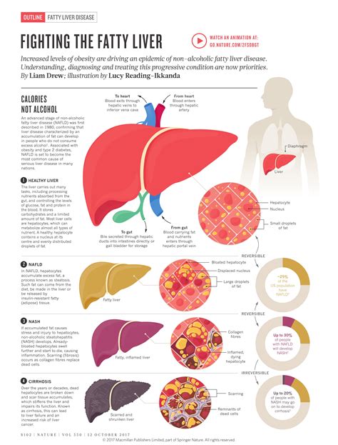 Dying Process From Liver Failure