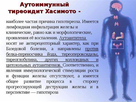 Диета при аит гипотериоз Безглютеновая Диета При Аутоиммунных Заболеваниях Аит Гипотериоз Безглютеновая Диета При Аутоиммунных Заболеваниях Аит Гипотериоз Диета при аит гипотериоз