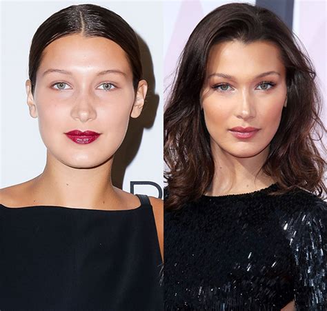 bella hadid nose job before and after