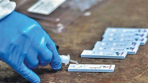 Mivel magának a vírusnak a jelenlétét mutatja ki, ezért a legmegbízhatóbb vizsgálati módszerként tartják. Telangana: Acute Shortage of RT-PCR Test Kits in TS