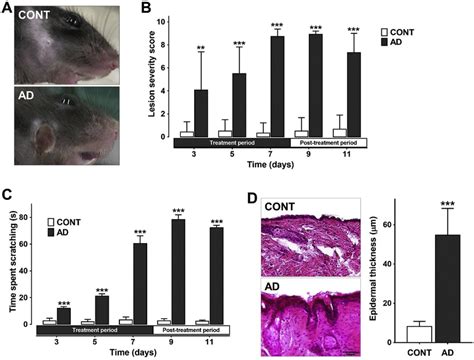 Development Of The Ad Like Symptoms In Mice Treated With Mc903 A