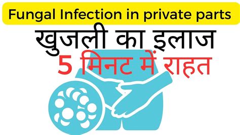 Fungal Infection In Private Parts Home Remedy In Hindi Youtube