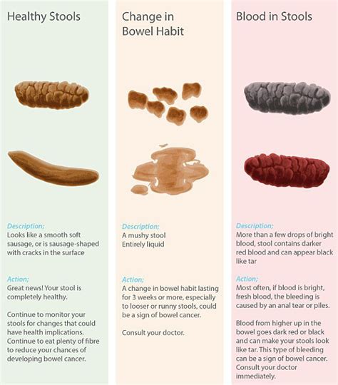 Most commonly associated with skin cancer, these may start to develop anywhere, including in the colon or rectum, or may spread to the gi tract from the primary melanoma site. Pictures of in stool from colon cancer MISHKANET.COM