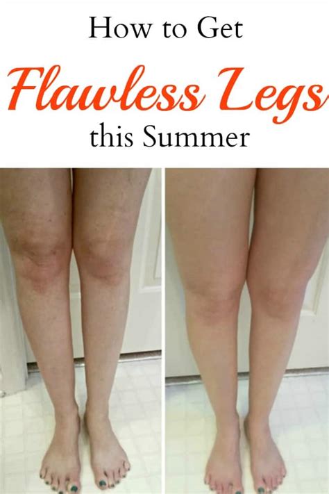 How To Get Flawless Legs This Summer