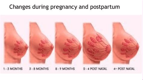 Check spelling or type a new query. Breast changes during pregnancy and postpartum