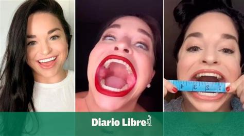 Video La “influencer” Que Obtuvo El Récord Guinness De La Mujer Con La Boca Más Grande Del