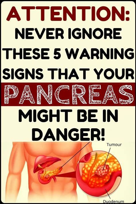 Cancer in the pancreas occurs when the cells in the pancreas we do not know what causes pancreatic cancer. Exceptional Natural home remedies information are offered ...