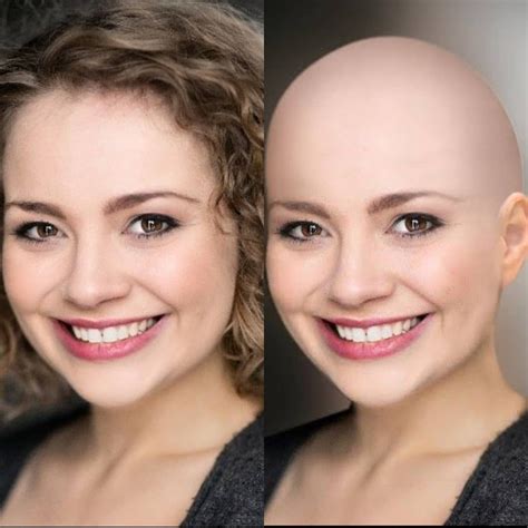 This Is A Before And After Of Carriehopefletcher Before With Her And After Bald Bald Girl