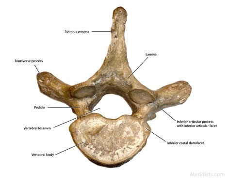 In total there are 12 thoracic vertebrae. Anatomy of the Thorax → Thoracic Vertebral Column ...
