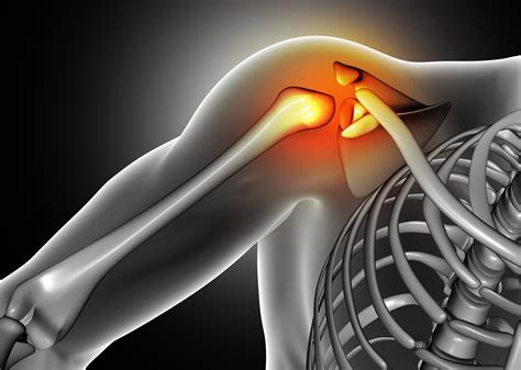 Rotator Cuff Tendinopathy Physiophi Physiotherapy In Jindalee And Darra