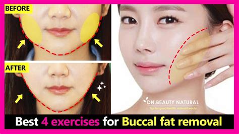 Best 4 Exercises For Buccal Fat Cheek Fat Removal Naturally How To