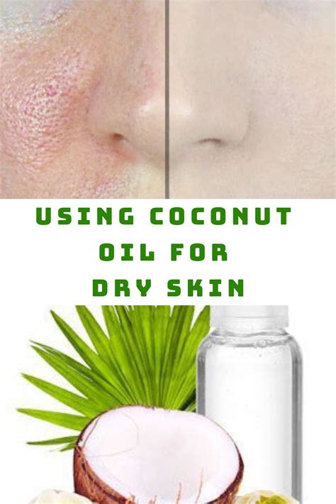 Using Coconut Oil For Dry Skin Will Bring These Surprising Benefits