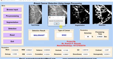 Types Of Breast Cancer Detection Using Matlab Source Code ~ Engineering Projects